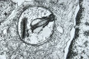 M,28y. | Leishmania - skin M,28y. | Leishmania - skin